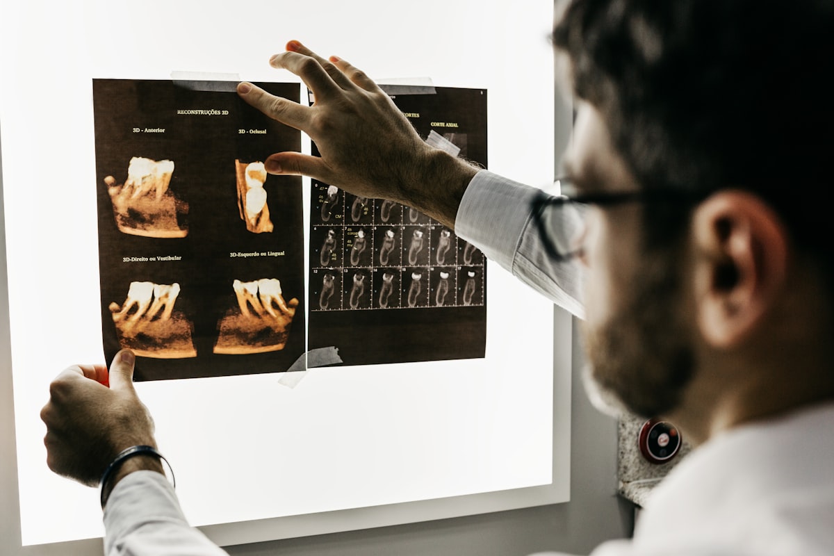 A dentist reviewing dental x-ray images on a light box while assessing a possible cracked tooth at Orchid Dental Wellness, Bhopal